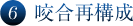 6 咬合再構成