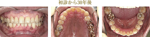 初診から30年後