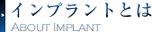 インプラントとは